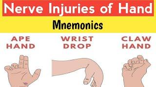 Ape Hand,Wrist Drop,Claw Hand |Radial,ulnar,median nerve injuries
