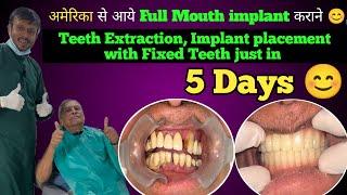 अमेरिका से आये Full Mouth Dental Implant कराने | Best Dental Implant in India