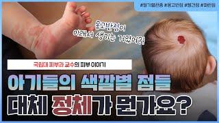 아기의 빨간 점, 파란 점 대체 왜 생기는 걸까?｜⭐영아혈관종, 몽고반점, 화염상모반 완벽 정리⭐  - [언니네피부과]