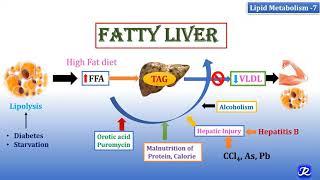 7: Fatty Liver | Lipid Metabolism-7 | Biochemistry | N'JOY Biochemistry