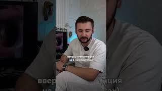ТОТАЛЬНАЯ имплантация зубов #стоматология #зубы #имплантация
