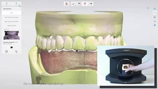 3Shape Dental System - Single Full Denture Scanning Workflow