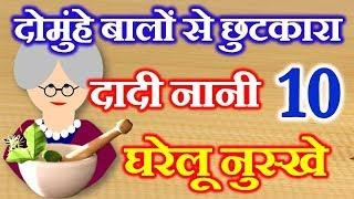 10 Home Remedies for Splits End Hair दादी नानी घरेलू नुस्खे Do muhe Balo Se Chutkara