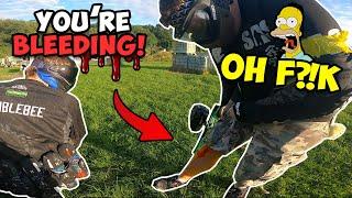 PAINTBALL FUNNY MOMENTS & FAILS ► INJURIES IN PAINTBALL 