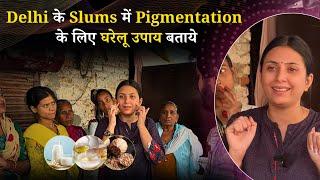 Delhi के Slums में झाइयों का इलाज बताया | Pigmentation Melasma Home Remedy | Upasana Ki Duniya