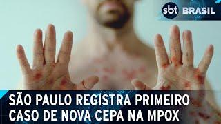 São Paulo confirma primeiro caso de nova cepa da Mpox | SBT Brasil (08/03/25)