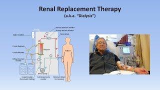 Acute Kidney Injury (Part 3/3 - Treatment and Complications)