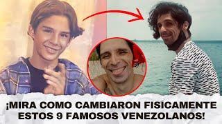 9 Famosos venezolanos que cambiaron MUCHO fisicamente. Quizás no los reconocerás.