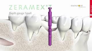 Zeramex T+XT Surgery Animation