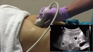 How I do it: Ultrasound of the Abdomen