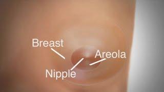 Mastectomy | Breast Reconstruction Overview