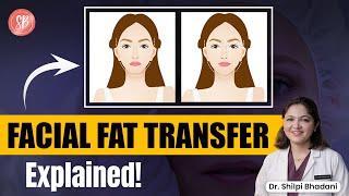 Facial Fat Transfer | Facial Fat Transfer for Acne Scars | Facial Fat Grafting | SB Aesthetics