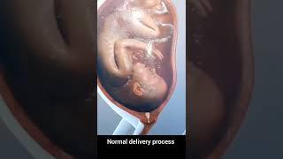 normal delivery process in few seconds #baby #pregnant #women