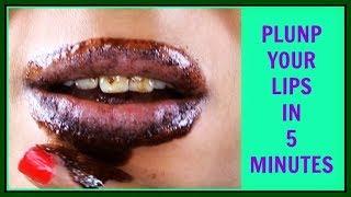 NATURAL LIP PLUMPER | HOW TO GET FULLER LIPS NATURALLY | Khichi Beauty