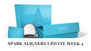 SPARK ALIGNERS WEEK 4| COCO STYLESNY