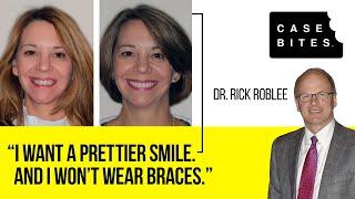 Case Bite #2: Minimally Invasive Smile Transformation
