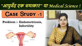 Case Study 1:  Successful Endometriosis Treatment  |  Infertility Treatment |  Dr Chanchal Sharma