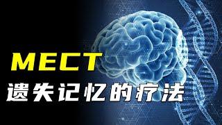 “黑掉大腦，重啟系統”，能讓你失去記憶的治療方法，你願意嗎？【颀思诺想】