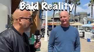 The Truth About Being Bald | Part 3