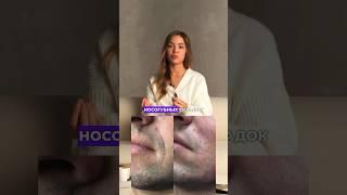 Полное видео про процедуры для мужчин уже на канале #косметология #ботокс #процедурыдлямужчин