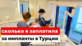 СКОЛЬКО СТОИТ ВСТАВИТЬ ЗУБЫ В ТУРЦИИ. ГДЕ СТАВЯТ ИМПЛАНТЫ ЕВРОПЕЙЦЫ