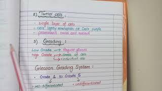 Prostate Carcinoma Pathology ( Morphology and Gleason Grading)