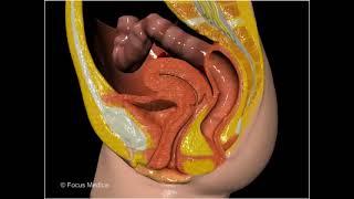 Anal sphincter dysplasia - Gastroenterology