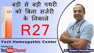 बड़ी से बड़ी पथरी को बिना सर्जरी के निकाले | R27 | Uses of Reckeweg R27 | Reckeweg R27 Review