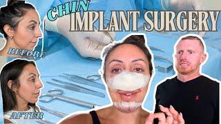 Chin Implant and Deviated Septum Surgery Results: My Honest Review