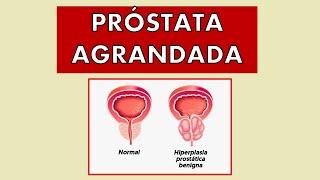  PROBLEMAS de PRÓSTATA AGRANDADA | SÍNTOMAS, DIAGNÓSTICO Y TRATAMIENTO