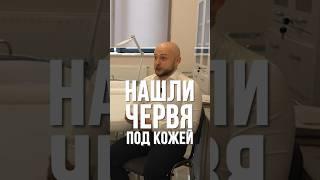 Нашли ЧЕРВЯ под кожей!