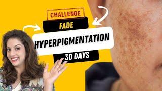 Incredible 30-Day Hyperpigmentation Removal Remedy at Home | Nipun Kapur's Expert Skincare Routines