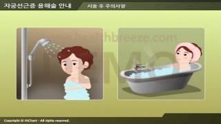 [시연용] c0060aako 자궁선근증 용해술 안내
