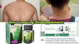 Beware of this Supplement! Ling-Zhi Ginseng, Chuang Yao Wan, Pambataba ng supplement