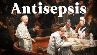 How Joseph Lister Changed Surgery Forever (Invention of Antiseptic Surgery)