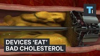 Devices 'eat' bad cholesterol