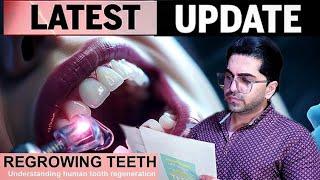 Special Report: How to Regrow Teeth Using Usag1 Blocker | Teeth Regrowth Breakthrough Revealed