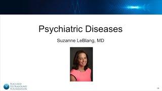 Suzanne LeBlang, MD: Focused Ultrasound for Psychiatric Diseases