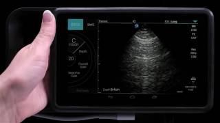 Sonosite iViz 5: Performing an Exam