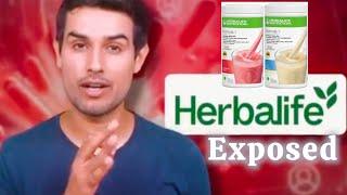 Dhruv Rathee Exposes Herbalife: The Truth About Their Shakes & Supplements #exposed #dhruvrathee