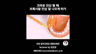 크라운 인상 뜰 때 프록시말 인상 잘 나오게 하기  #치과위생사  #치위생사 #치과