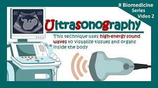 Ultrasonography | USG | The Principles of Ultrasound Imaging | Clinical application of USG | Biology