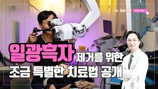 #일광흑자 제거를 위한 조금 특별한 치료법 #닥터최승 #흑자 #검버섯 #기미 #색소 #혈관 #주사 #청담노엘의원 #청담동피부과