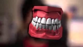 Laser Treatment For Gum Disease in Macomb County, MI - Dr. Joseph Nemeth