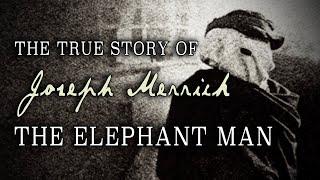 "The True Story of Joseph Merrick: 'The Elephant Man'" (1997)