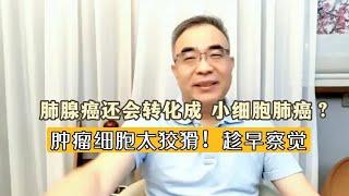 肺腺癌治疗后，有些会变成鳞癌、小细胞肺癌？癌细胞太狡猾了