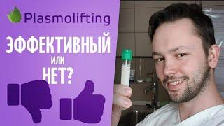 Плазмолифтинг(plasmolifting)\PRP. Эфективность процедуры. Мнение врача