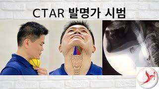 [Korean] Dysphagia Swallowing Exercise - Chin Tuck Against Resistance with Ball by CTAR Inventor