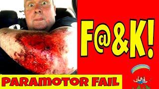 Paramotor Fail - Ouch That Hurt!