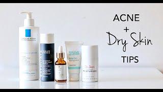 How To Treat Dry Skin + Acne